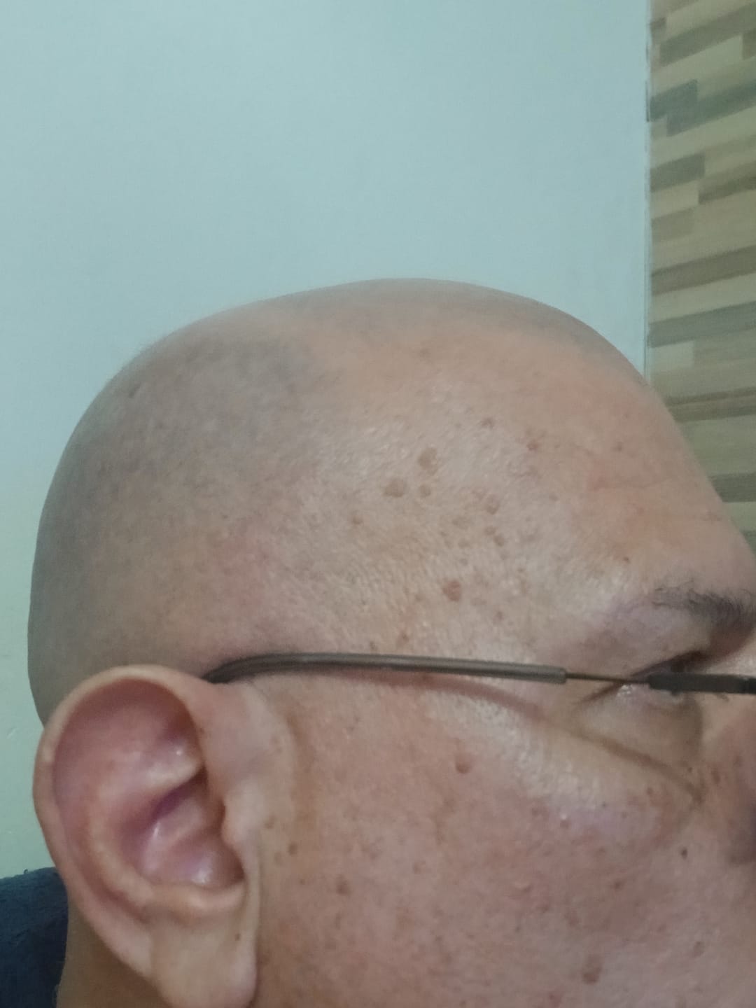 Foto da avaliação